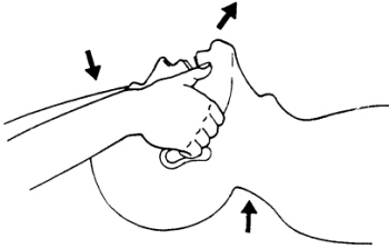 Apertura de las vías respiratorias