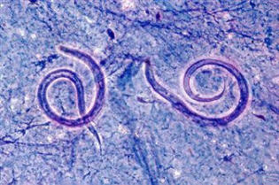 Los nematodos (Ascaris lumbricoides) se han utilizado con éxito en el control selectivo de determinadas plagas, como las babosas. Arriba unos nemátodos vistos al microscopio; abajo una babosa Lehmania Valentinana