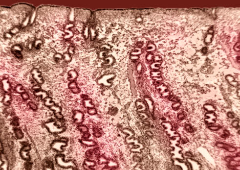 Ilustración de las glándulas del endometrio humano en la fase de menstruación