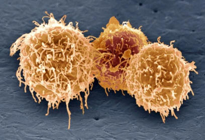 Células de glóbulos blancos o leucocitos