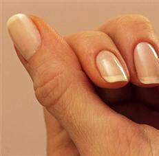 La queratina es una proteína fibrosa fundamental en la composición de variadas formaciones dérmicas, como las uñas