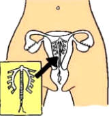 Educación sexual - Métodos anticonceptivos - DIU