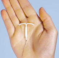 Educación sexual - Métodos anticonceptivos - DIU