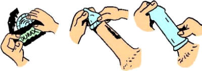 Colocación correcta del condón