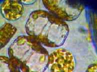 diatomea vista al microscopia