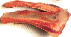 Carne de pecho sin hueso