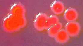 Bacteria Escherichia coli