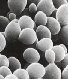 Levadura vista al microscopio