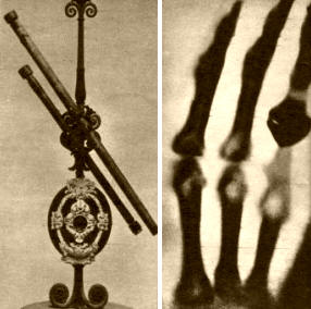 AMBOS ANTEOJOS (izquierda) pertenecieron a Galileo y aún se conservan. A la derecha, la primera radiografía.