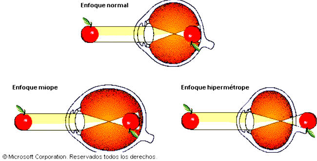 Visión estereoscópica