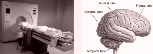 La observación del cerebro en funcionamiento