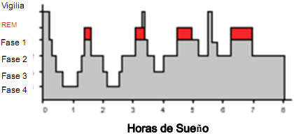 Una noche normal de sueño consiste en un patrón formado por distintas fases de sueño, con pequeñas explosiones de sueño REM (áreas en rojo) que aparecen más o menos 4 veces por noche