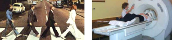 Izquierda: Parte de los beneficios ingresados por EMI con la venta de los discos de los “Vétales” ayudaron a pagar el desarrollo de los primeros scanners cerebrales. Estos y otros equipos desarrollados posteriormente han permitido a los neurocientíficas mirar el cerebro de una forma diferente. Derecha: Un scanner MRI moderno. El paciente yace en una mesa que se mueve dentro del anillo de imanes para realizar el scanner.