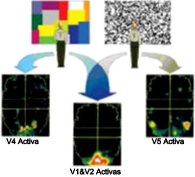 La persona del scanner ha sido expuesta a distintas imágenes. Todas ellas van a “iluminar” o activar las áreas primarias de la corteza visual. El uso inteligente de las técnicas de substracción ha revelado que el procesado del color (izquierda) se lleva a cabo en el área V4, mientras que el procesado del movimiento (puntos aleatorios moviéndose en una pantalla, derecha) activa el área V5.
