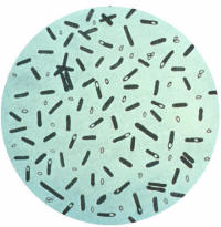 La posible contaminación microbiológica, por ejemplo por clostridium botulinum, constituye una gran preocupación para el sector lácteo