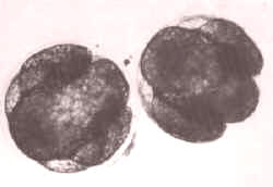 Fases de un decápodo (langostino)